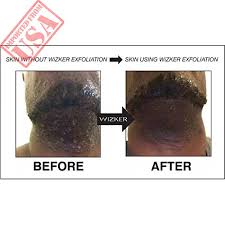  it helps prep the skin and hair by removing dead skin cells that can cause irritation. Buy Exfoliating Brush Wizker Wet Dry Original Bump Ingrown Hairs Firmflex Bristles Sale In Pakistan