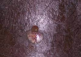 Grano Ingle Sin Cabeza Actualizado Febrero 2022