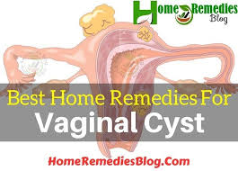 Pin On Natural Remedies