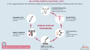 File In Vitro Fertilization Ivf English Png Wikimedia Commons