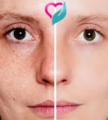 30 Med remedies ideas