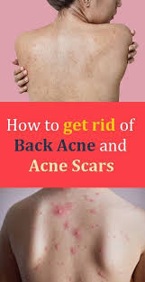 When once it gets absorbed by the skin then pour 1 tablespoon of olive oil on a second wet washcloth. Pin On My Saves