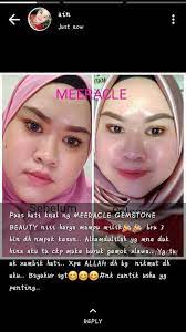 Dalam gambar last orang pakai kemeja kelabu tu nampak terpegun. Skin Dah Cantik Tapi Bila Pakai Meeracle Beauty Kuching ÙÙŠØ³Ø¨ÙˆÙƒ