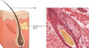 Image result for Sebaceous Gland