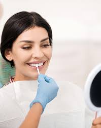Teeth Whitening in Scripps Ranch & Mira Mesa
