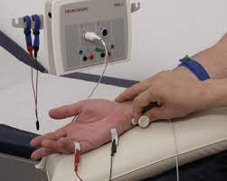 Weitere Diagnostik Polyneuropathie Selbsthilfeforum