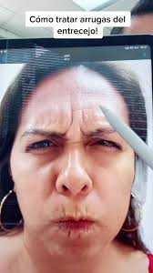 Cómo quitar arrugas del entrecejo fácilmente