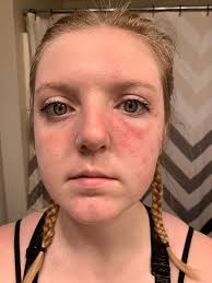 Saying Goodbye to a Beloved Pet Due to Cancer