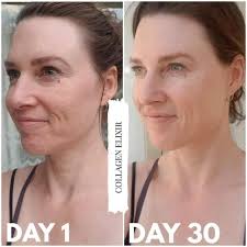 Including what percent is in anagen (growth) phase verusus telogen (resting) phase in each region of the body at any given time. Buy The Isagenix Collagen Elixir
