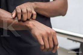 Dilansir dari health line, tanda atau gejala awal hiv mungkin muncul sebagai gejala yang mirip dengan gejala flu (influenza). Inilah 5 Gejala Hiv Yang Perlu Anda Waspadai Apa Saja