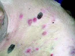 If this seems to cause your pet discomfort dogs can develop cancerous tumors in their skin. Comparative Oncology Of Skin Cancer Oncohema Key