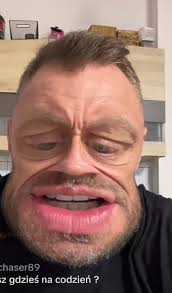 Fani martwią się o zdrowie psychiczne rapera Malichy, który na ostatniej  gali FAME został znokautowany przez Alberto. Raper codziennie od porażki  publikuje filmy z zaplecza FAME MMA oraz media treningu. Fani  Mailiszewskiego