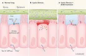 Cystic fibrosis foundation consensus report. Pore Forming Small Molecules Offer A Promising Way To Tackle Cystic Fibrosis