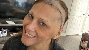 Fundraiser for Angelica Chacon by Leonor Chacon : Recuperación: Angelica  Carolina