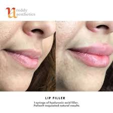 Choose our licensed specialists for your next aesthetics . Reddy Aesthetics 4241 Atlantic Ave Long Beach Ca Medical Spas Mapquest