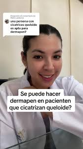 Riesgos del Dermapen en pacientes que cicatrizan queloide