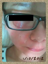 Food and cosmetic use precautions: Organic Aid Vit E L U N A B Y S S