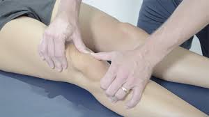 Image result for Patellar Tilt Test