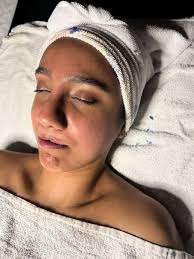 Ulrimate Lifestyle Face Lift Paul