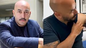 Lupillo rivera se elimina el tatuaje de belinda según él por respeto a su esposa y a través de su cuenta de instagram publicó el video dando una breve explicación y el proceso doloroso por el que tuvo que pasar para eliminar de su piel a su ex pareja sentimental. Svo6twjvu Q7hm
