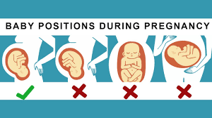 What Is Anterior Posterior Breech And Transverse Lie Youtube