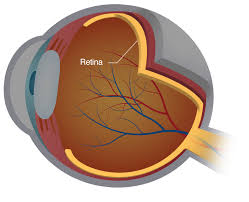 How is a detached retina treated? Repairing Damaged Retinas Kansas City Mo Tear Detachment Treatment