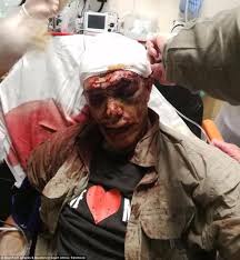 Résultat de recherche d'images pour "south africa white farmer murders"