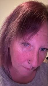 Hair growth and breakage after straightening