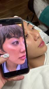 Chăm sóc da mụn hiệu quả tại Sài Gòn