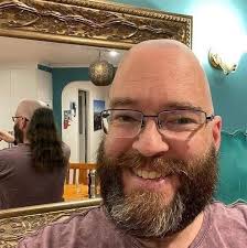 The Skullet is the new Hairstyle Trend