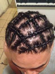 pineapple cornrows