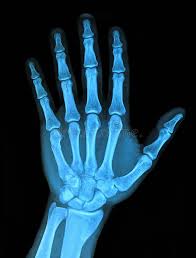 Image result for Hand XRay