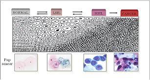 Cervical cancer is the third most commonly diagnosed cancer worldwide and the fourth leading cause of cancer death in women1. New Biomarkers For Cervical Cancer Perspectives From The Igf System Intechopen