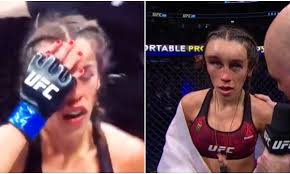 Sweet sweat and joanna jedrzejczyk nov. Joanna Jedrzejczyk Mowi O Koszmarnym Krwiaku Skora Mogla Peknac