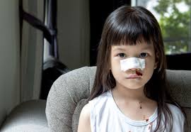 Penyebab jerawat yang sering diabaikan orang 2. Kenapa Hidung Berdarah Hemofilia Adalah Salah Satu Puncanya