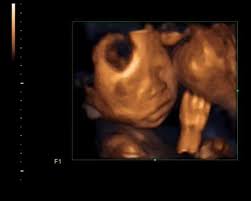 Maybe you would like to learn more about one of these? Successful 4d Ultrasound Imaging Of Fetal Face With Clear Facial Download Scientific Diagram