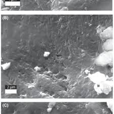 Looking for psychotherapists near me in bloomington, in? Pdf A Demineralized Osteostracan Fossil From The Silurian Kalana Lagerstatte Of Estonia Revealing Its Internal Anatomy And Uncovering A Unique Type Of Fossilization