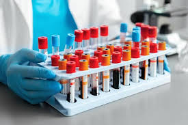 Лаборатория по сбору анализов | Бизнес идея 2024