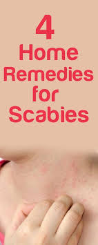 For Scabies Home Remedies For Scabies Scabies Home Remedies