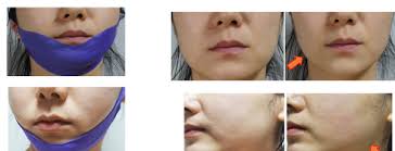 I M Skinny But I Seem To Be Getting Some Chin Fat What Should I Do To Get Rid Of It 2019 Quora