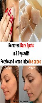 Pin On Skin Lightening Lemon