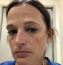 YEAR OF THE NURSE GAINS NEW MEANING