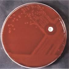 Image result for Group D Streptococcus
