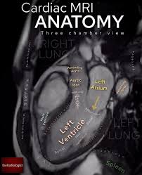 Image result for Cardiac MRI