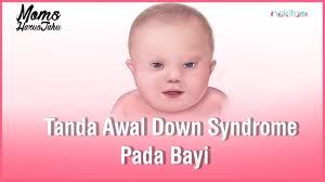 Tahun lalu, bayi silas philips menjadi pemberitaan setelah lahir masih dalam kantung ketuban. Kenali Penyebab Penyakit Bayi Biru Salah Satunya Karena Cacat Jantung Semua Halaman Nakita