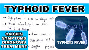 Typhoid fever, also known as enteric fever, bilious fever, yellow jack or commonly just typhoid classically, the course of untreated typhoid fever is divided into four individual stages, each lasting. Typhoid Fever Salmonella Typhi Causes Symptoms Diagnosis Treatment Bio Science Youtube