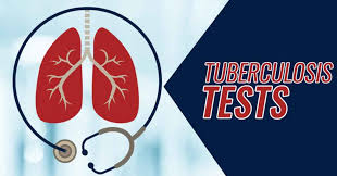 Most infections show no symptoms, in which case it is known as latent tuberculosis. Who Should Get A Tb Test And Why Elite Medical Center
