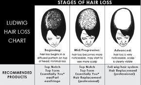 Stages Of Hair Loss Jon Renau Blog