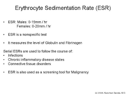 Pin On Autoimmune Disease Testing