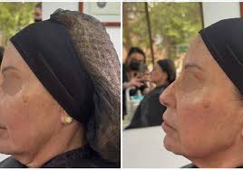 Clínica Dra. Azcárate